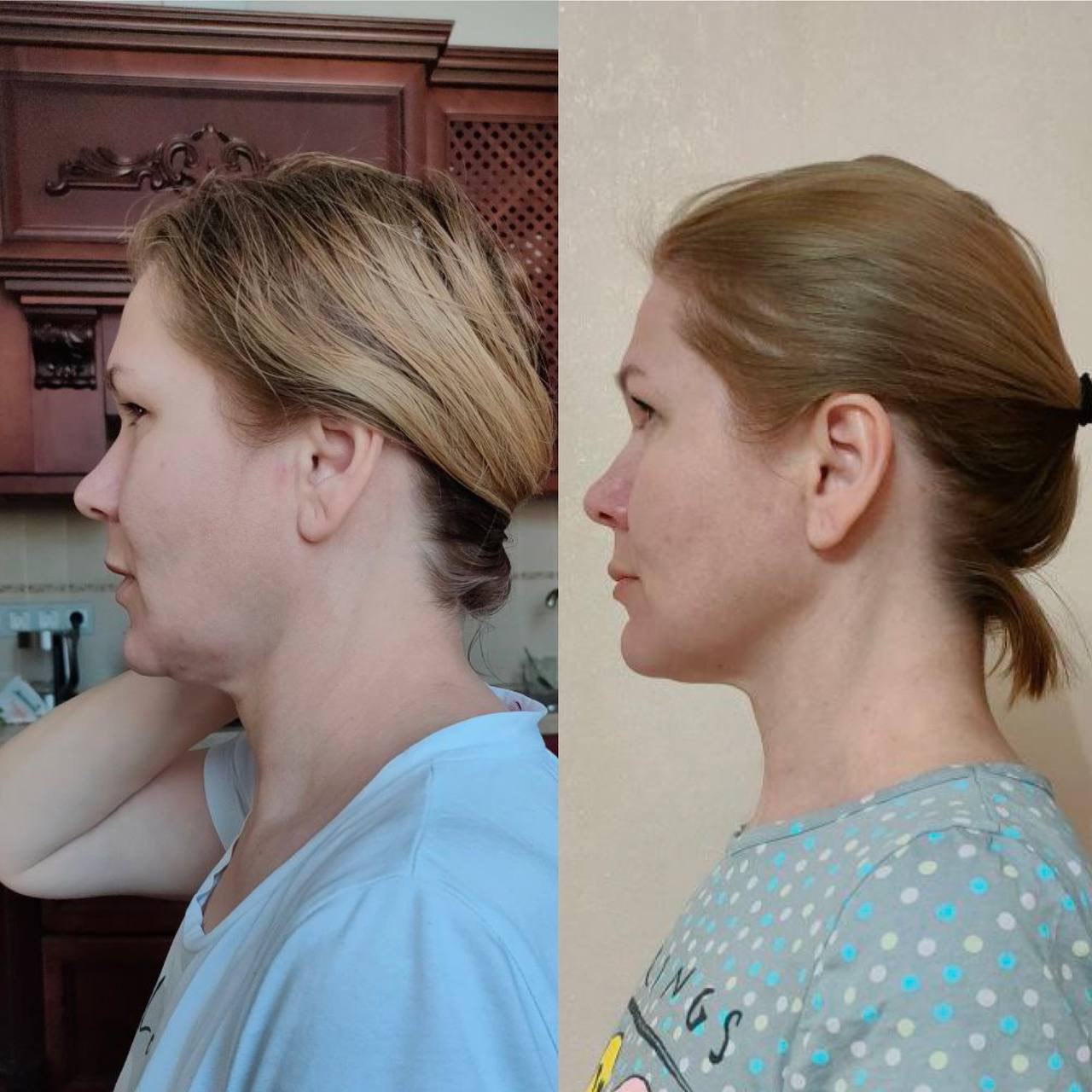 Student before-and-after result