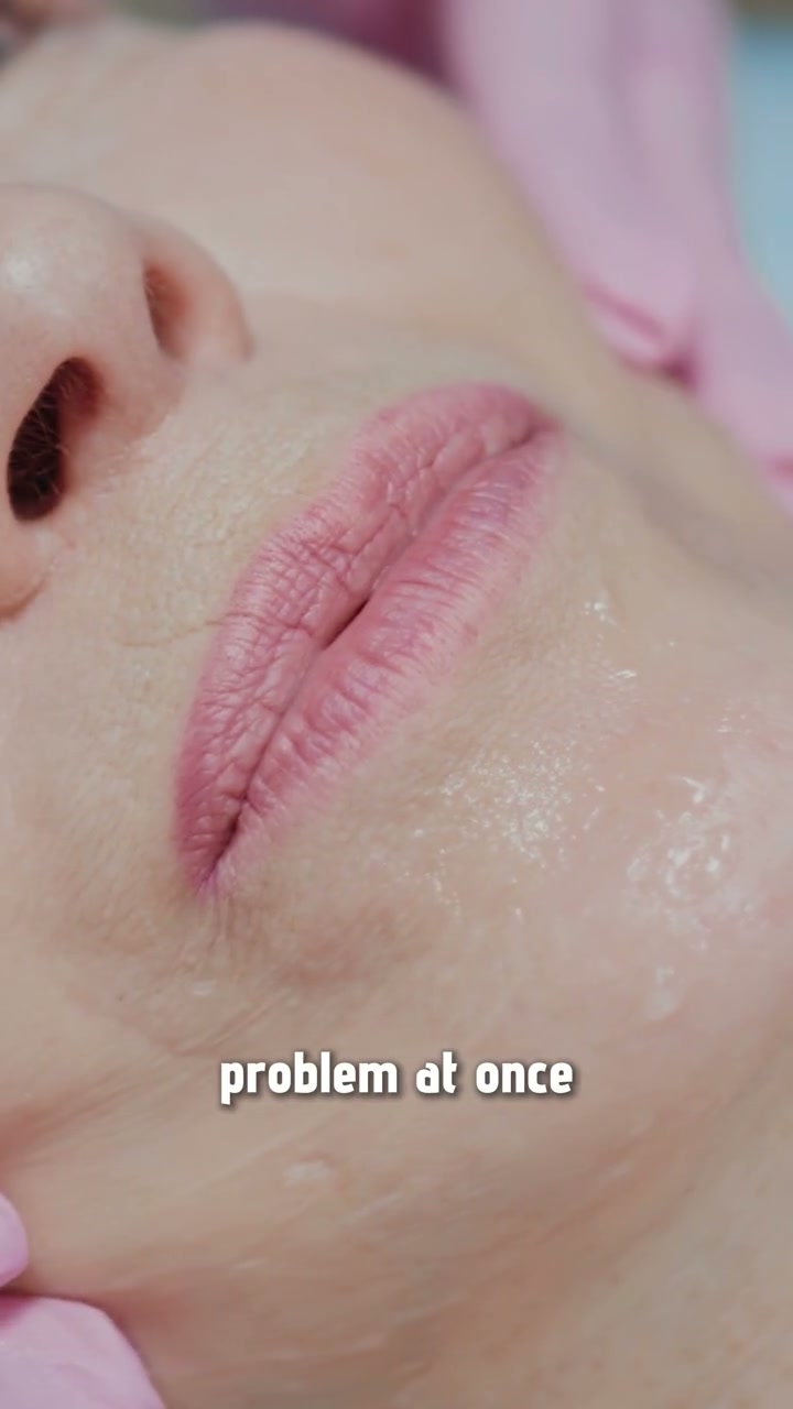 Preview from the short video about the lower face