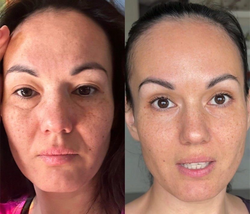 Marina's before-and-after result