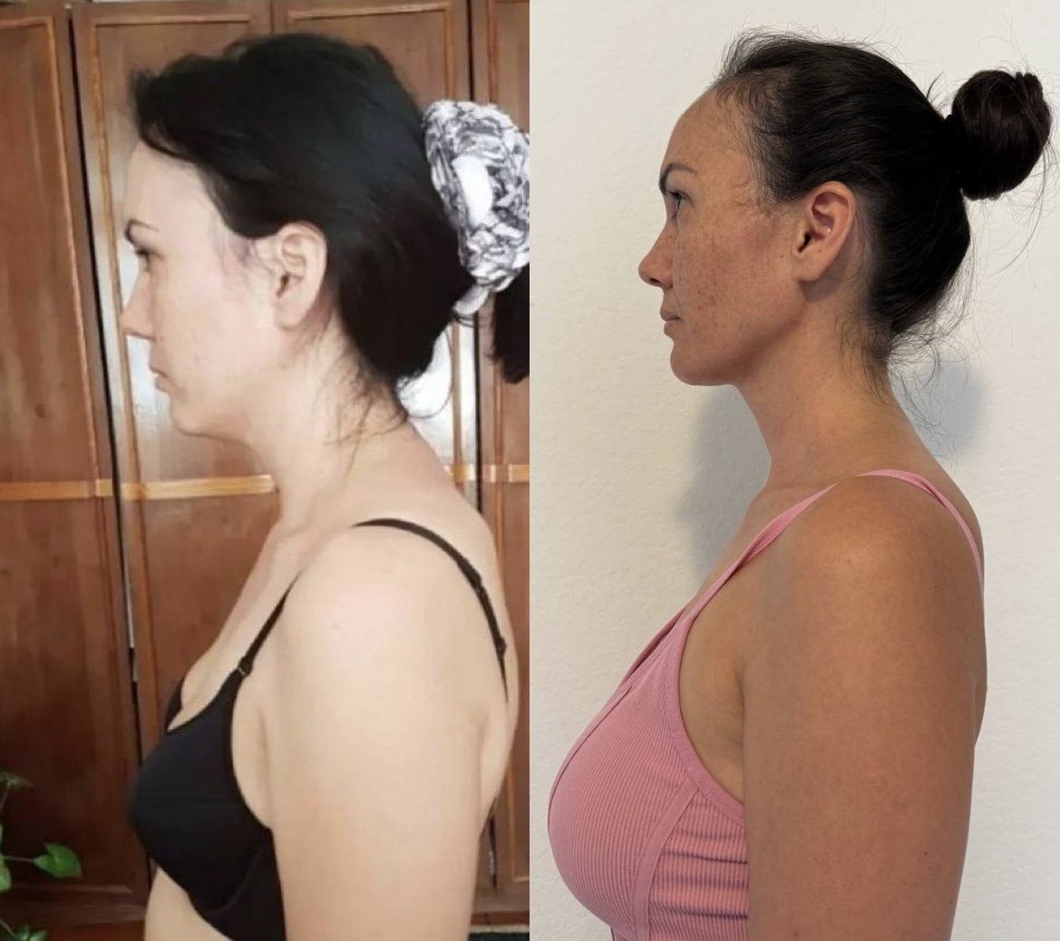 Marina's side-profile and posture before-and-after result