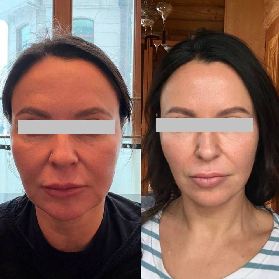 Student before-and-after result