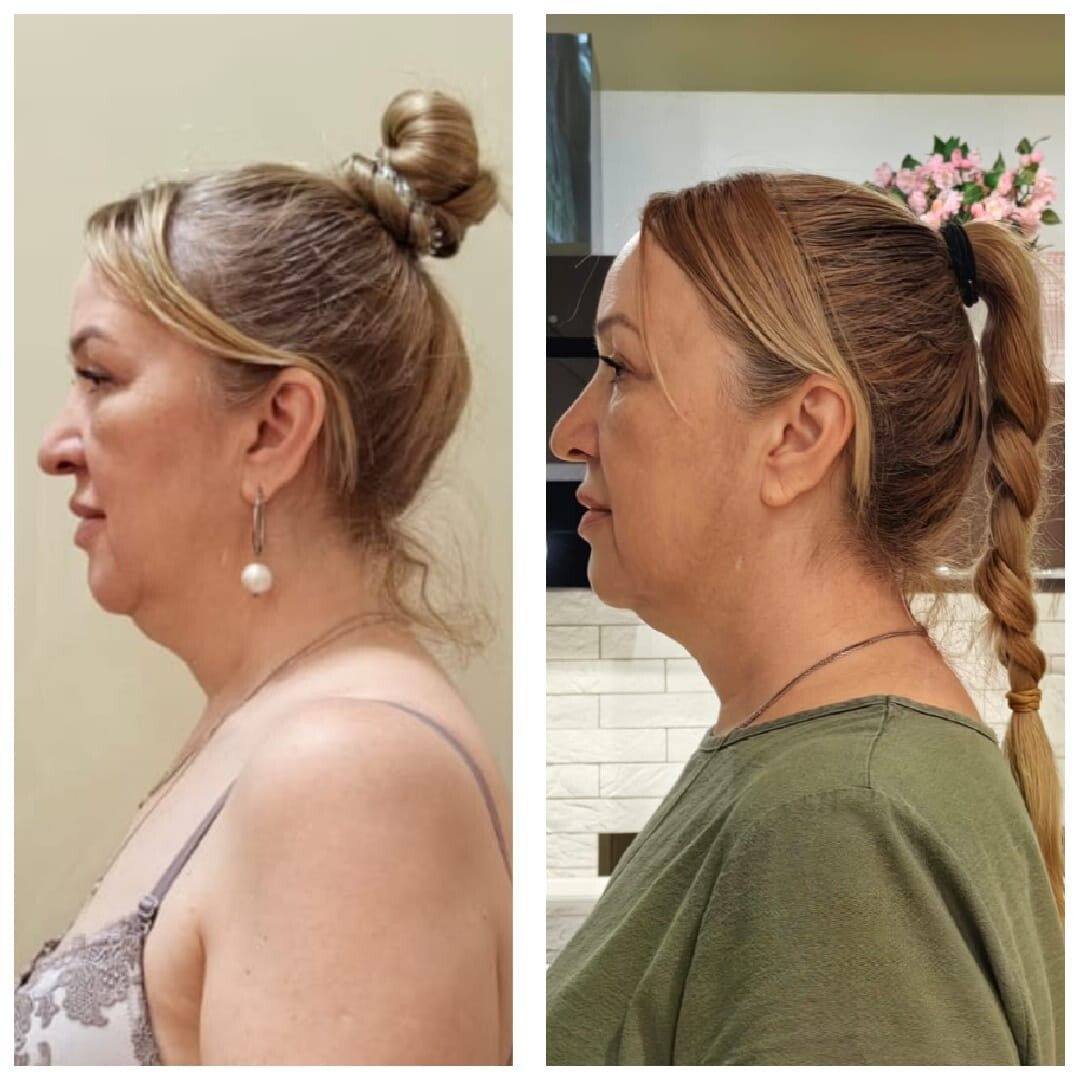 Student before-and-after result