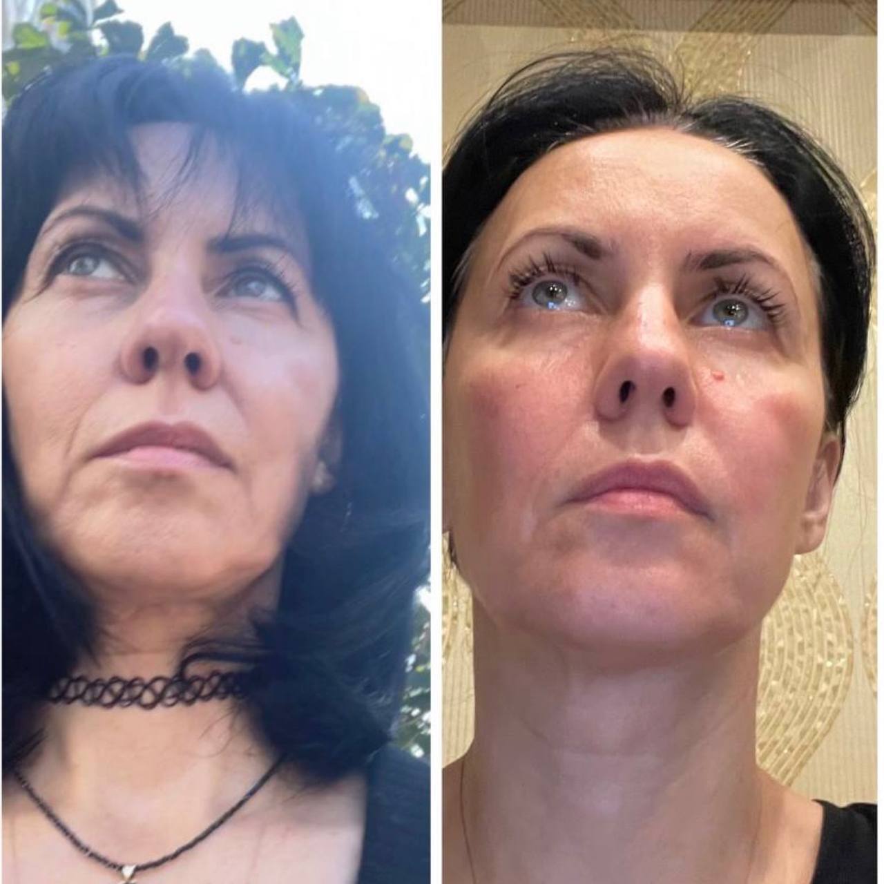 Student before-and-after result