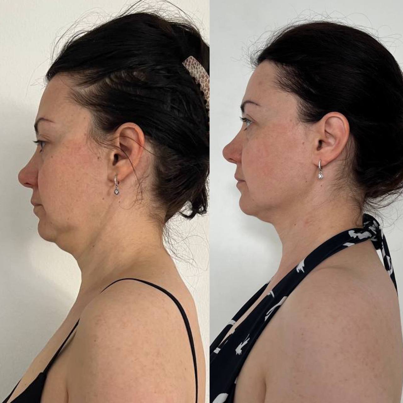 Student before-and-after result